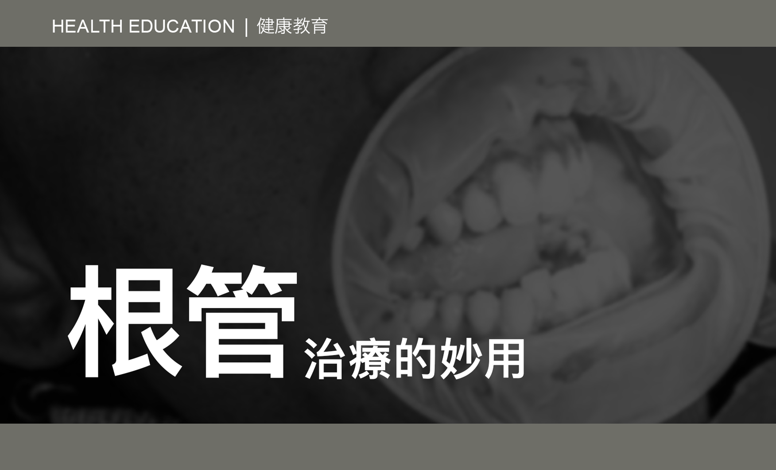 teethroot