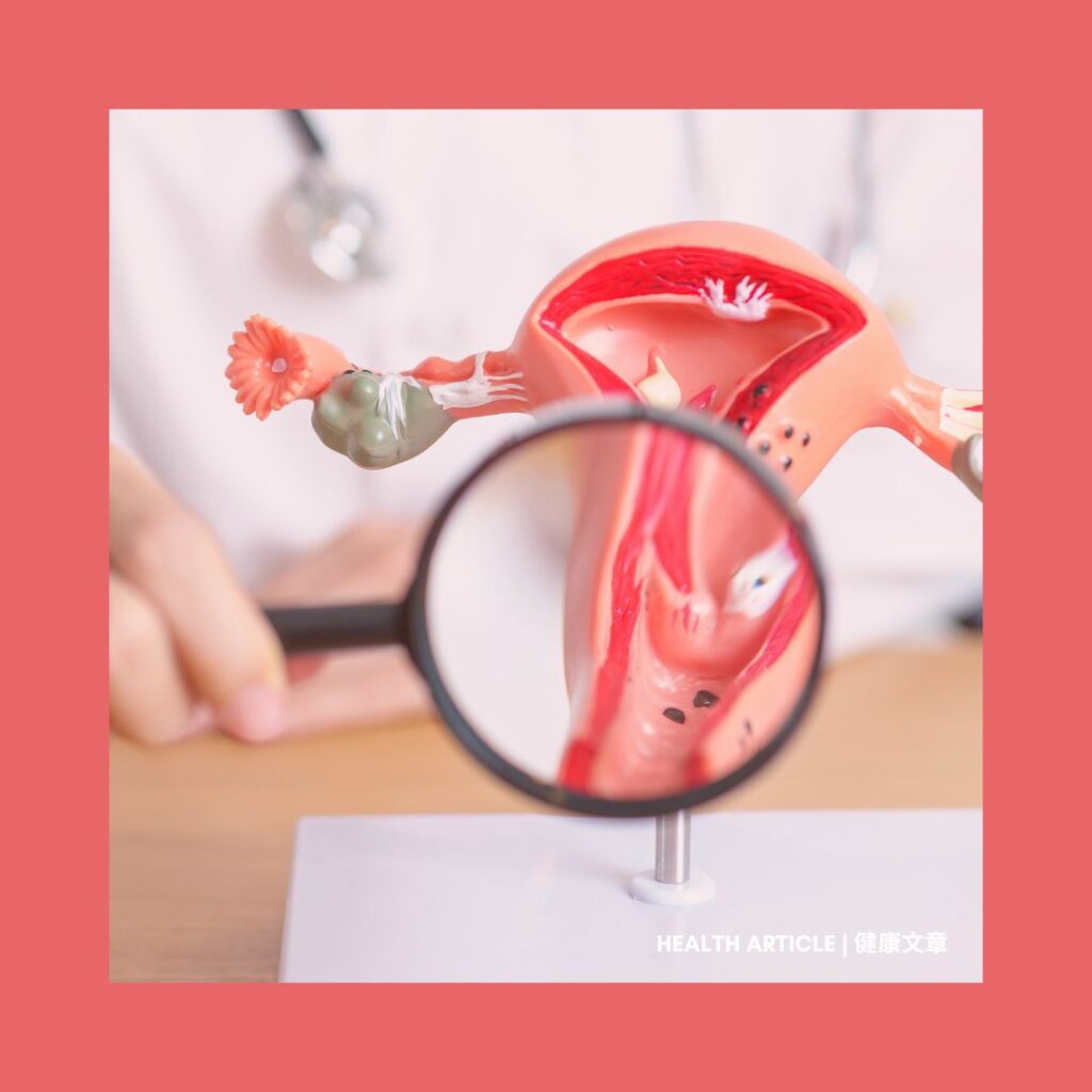 Health Article: 女性的隱形風險 子宮頸癌 | The Hidden Risk: Cervical Cancer