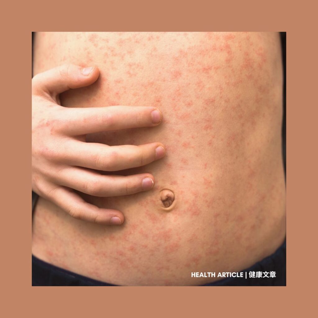 Health Article: Anti-Inflammatory Diet